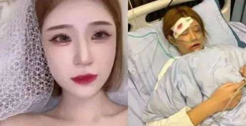 王多鱼“家暴重伤”，躺在医院diss男友，这般炒作只为卖手机电话卡？
