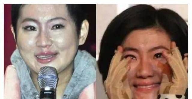 “苦命女神”任家萱，严重烧伤遭嫌弃，对前任下跪，父母后悔生她