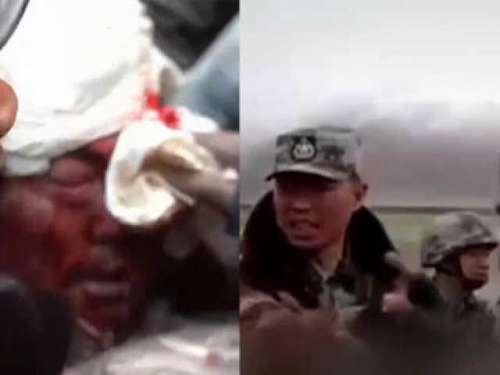 祁发宝头破血流扯掉绷带还想冲 怒斥印军：不想打就滚！
