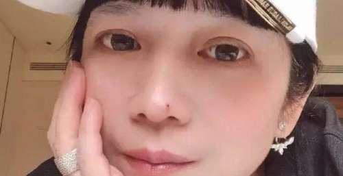 林瑞阳前妻再度发文！不想卷入张庭风波求放过：已影响我的生活