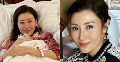 51岁李嘉欣自曝入ICU抢救48小时，网友：脸肿成熊黛林