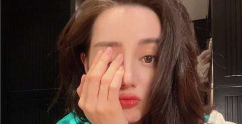 贴贴！迪丽热巴晒光影自拍 红唇嘟嘴俏皮美艳