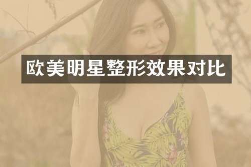 欧美明星整形效果对比